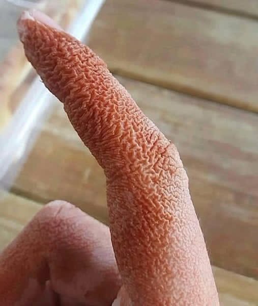 What Started as a Simple Rash Turned Into a Serious Medical Mystery