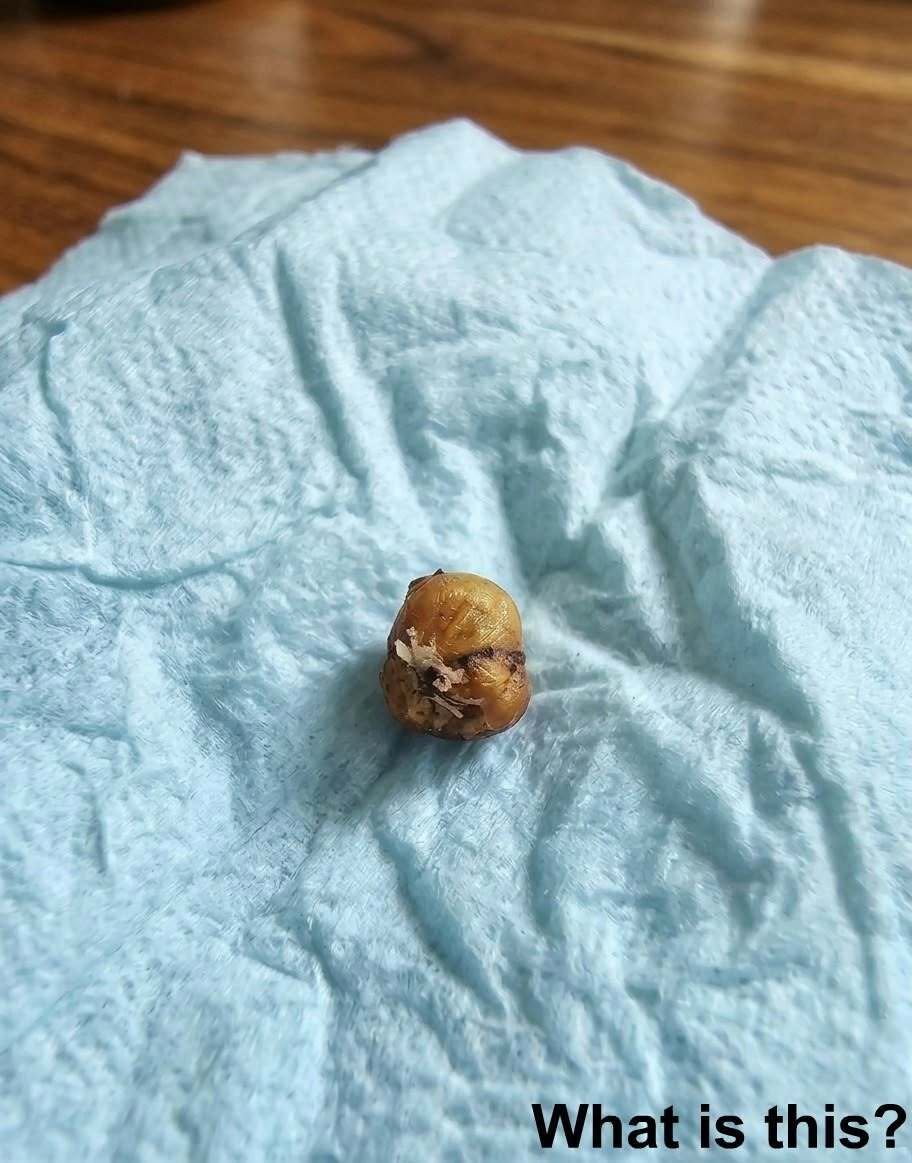 A Tiny Creature Fell From Her Hair—The Truth Was More Disturbing Than Anyone Expected