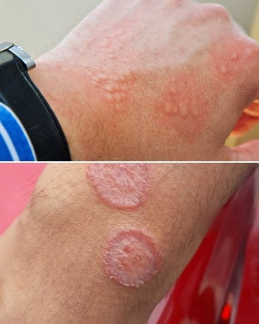 Your Skin Could Be Warning You About a Serious Health Problem