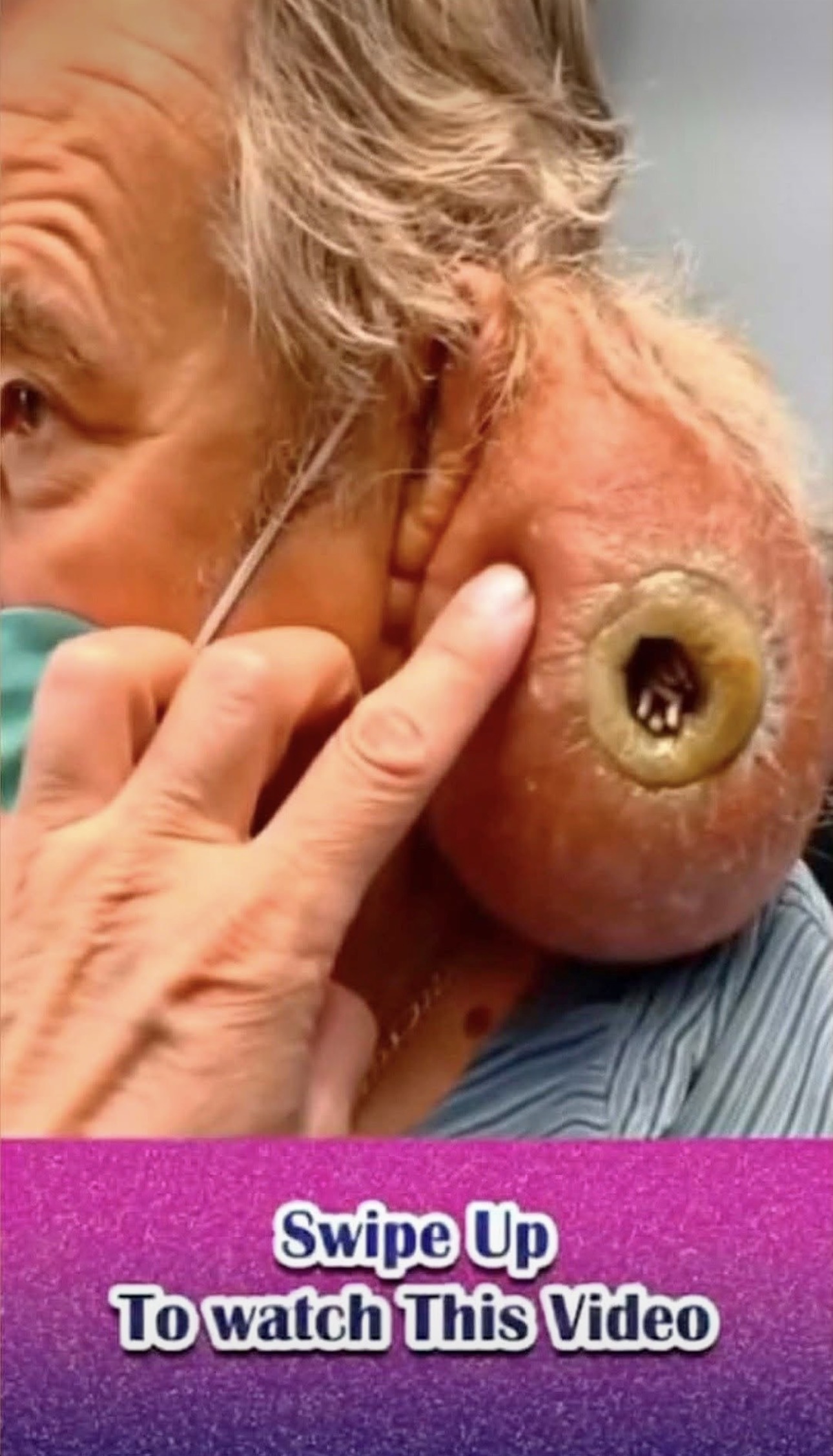 What Was Growing On His Ear?