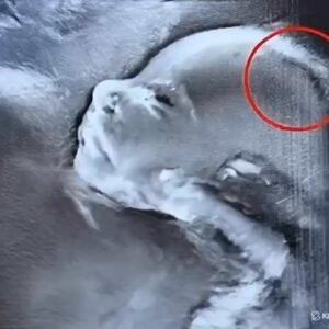 What Doctors Discovered During the Ultrasound Left Everyone Amazed