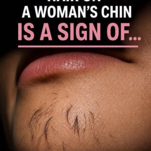 Chin Hair in Women: Common Causes and When It’s Worth Paying Attention